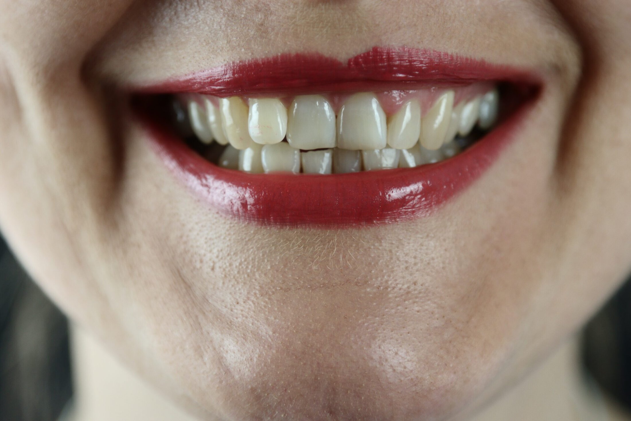 model with crooked teeth and red lipstick