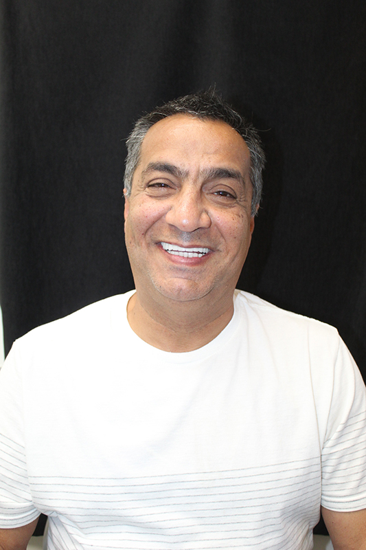 Sherman Oaks Cosmetic Dentistry Patient 50 - After